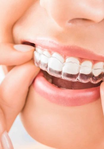 Bleaching Ludwigshafen - Dr. Susanne Axmann
