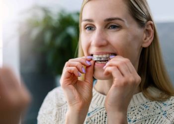 Aligner Lusdwigshafen - Modern Clear bei Zahnärztin Dr. Susanne Axmann