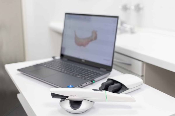 Intraoralscanner 3Shape